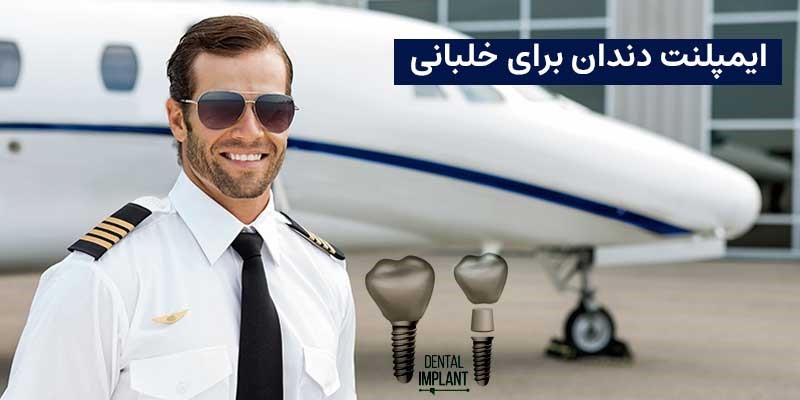 ایمپلنت دندان برای خلبانی