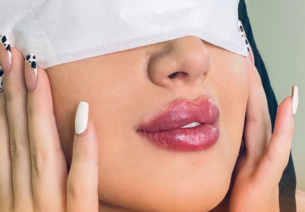 هزینه تزریق ژل لب