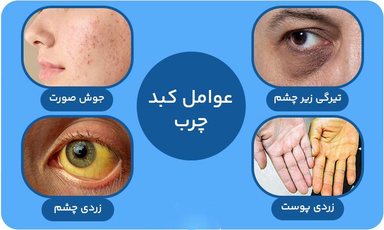 علائم بیماری واضح کبد بر بدن