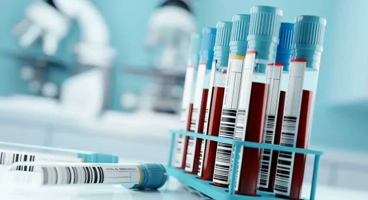 انجام آزمایش در منزل چه مراحلی دارد؟