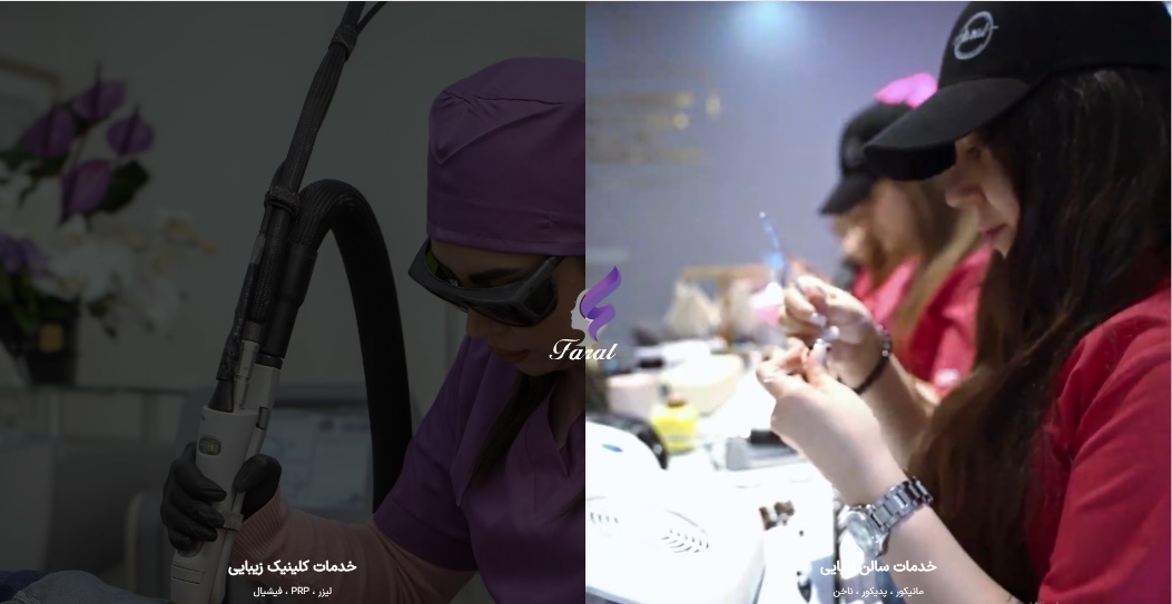 اکترولیز موهای سفید در تهران