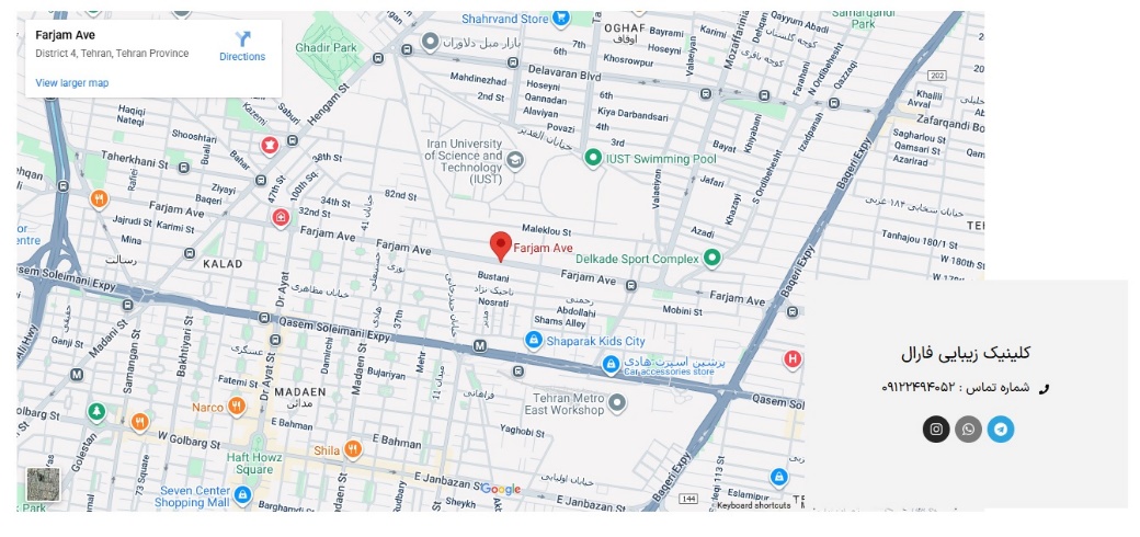 پی آر پی در تهران